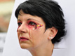 Sljepo�a zbog 'ljepote'